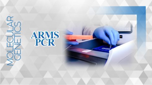 آرمز پی سی ار