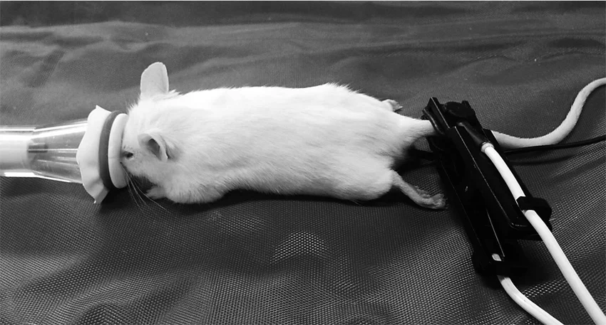 نظارت بر بیهوشی