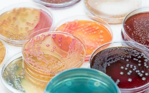 انواع محیط کشت در میکروبیولوژی و نحوه تهیه آن‌ها