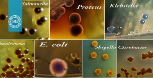 تشخیص و جدا سازی باکتری های گروه انتروباکتریاسه
