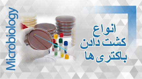 انواع-کشت-دادن-باکتری