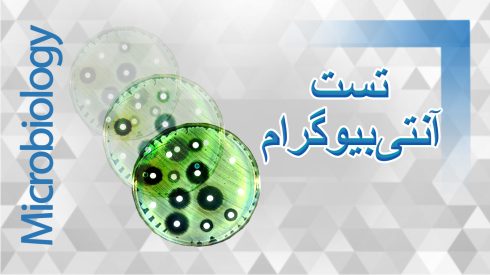 تست آنتی بیوگرام