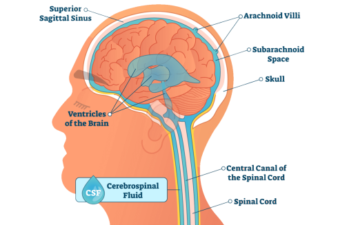 مایع مغزی نخاعی یا CSF