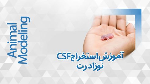 CSF یا مایع مغزی نخاعی
