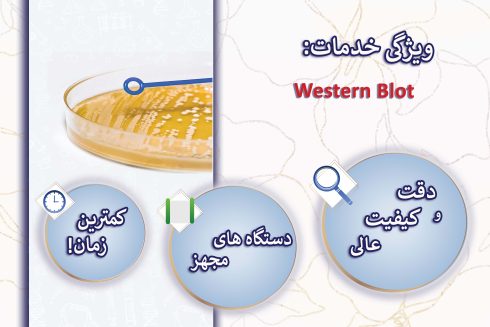 Western Blot