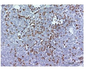 معرفی تکنیک ایمونوهیستوشیمی(IHC)