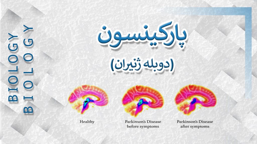 پارکینسون – دوبله ژنیران