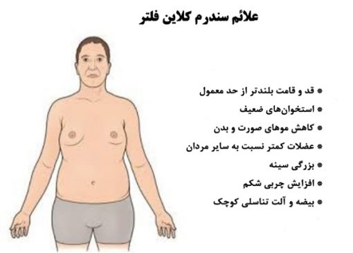 علایم سندرم کلاین فلتر