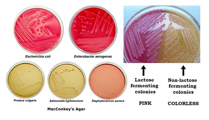 مورفولوژی کلنی در مک کانکی آگار