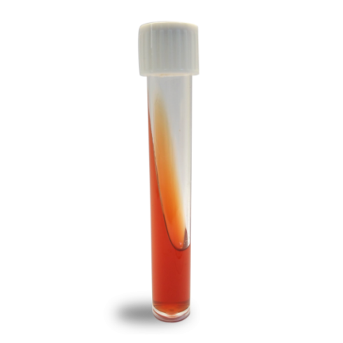 محیط Kligler’s Iron Agar