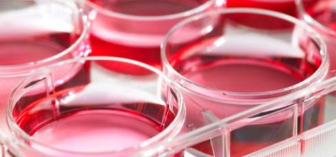 آبگوشت لیزوژنی (محیط لیزوژنی مایع) چیست؟