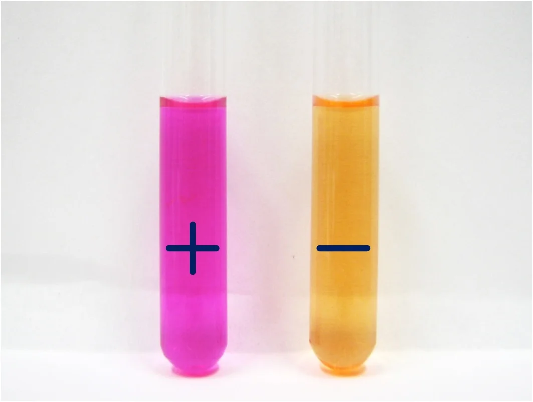 تست اوره آز