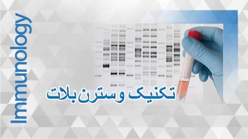 تکنیک-وسترن-بلات