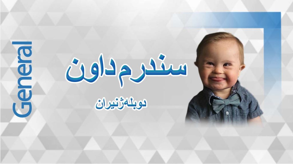 سندرم داون