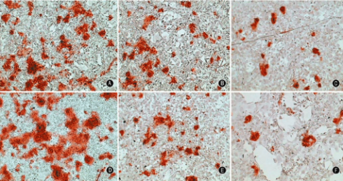 آلیزارین رد Alizarin Red S