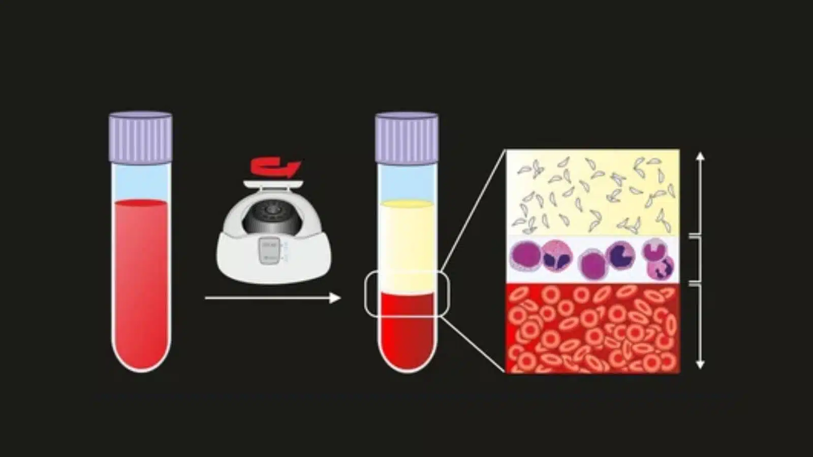 موارد استفاده ار بافی کوت