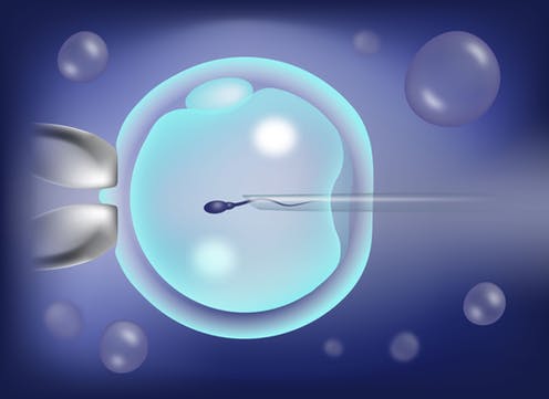 IVF چیست؟
