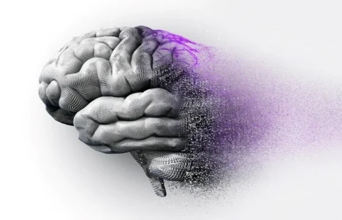 بیماری آلزایمر چیست؟