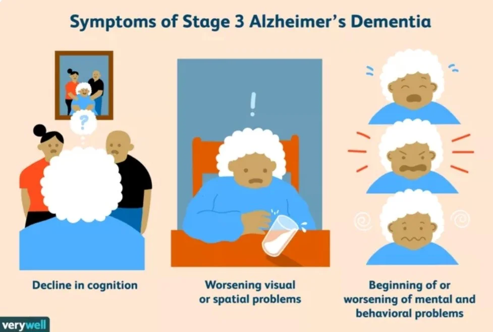 علائم بیماری آلزایمر