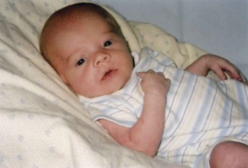 سندرم زلوگر