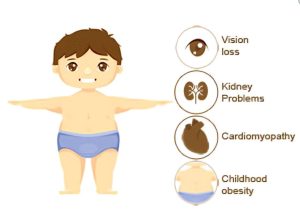 سندرم آلستروم