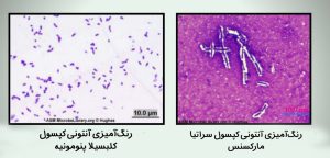 رنگ‌امیزی کپسول