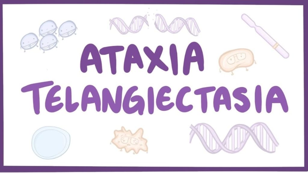 آتاکسی تلانژکتازی (Ataxia telangiectasia)