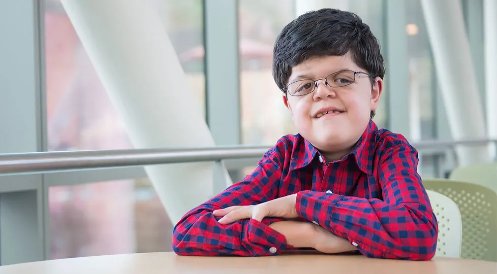 سندرم آپرت (Apert Syndrome) چیست؟