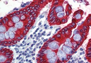 ایمونوهیستوشیمی (IHC)