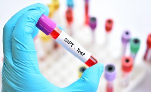 آزمایش غیر تهاجمی تشخیص پیش از تولد (NIPT)