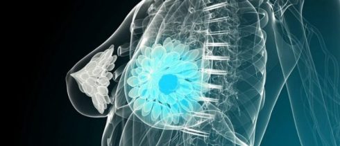 هوش مصنوعی می‌تواند در زمینه آموزش‌های مربوط به سرطان سینه به دانشجویان کمک کند