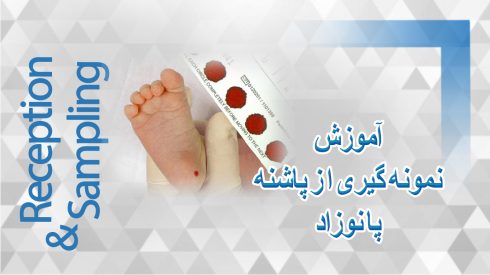 پاشنه پا نوزاد