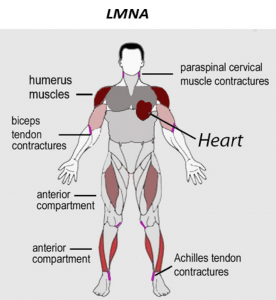 ایمری-دریفوس