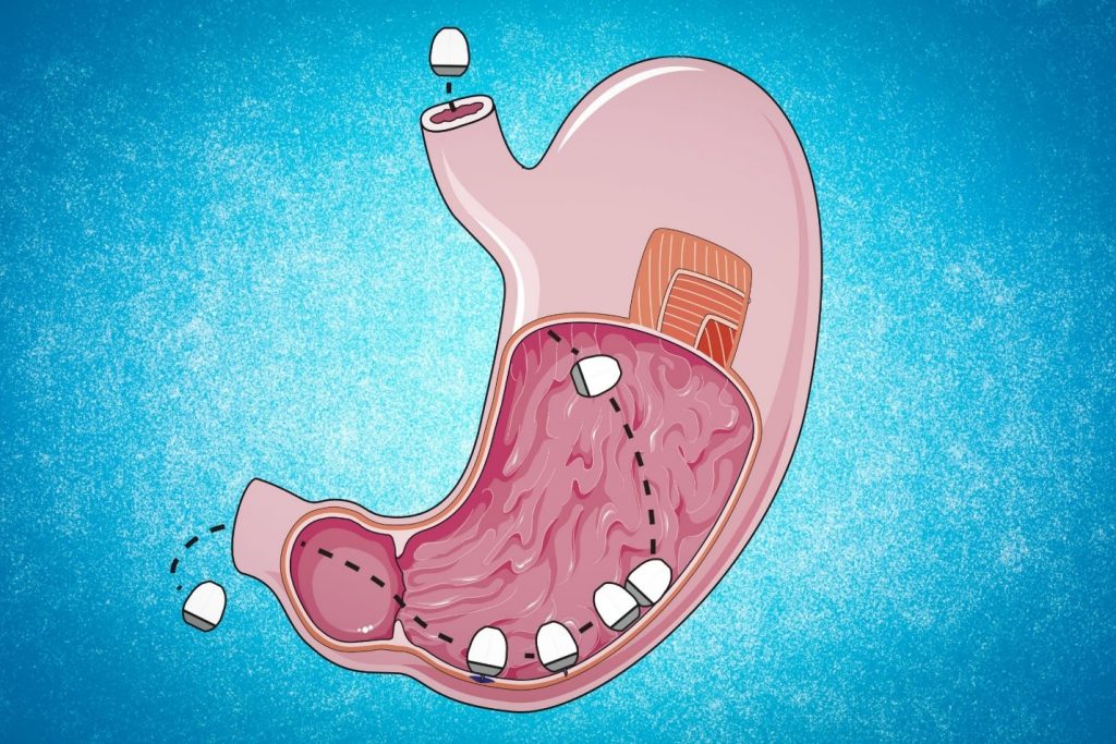 قرص RNA معده
