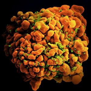 HIV