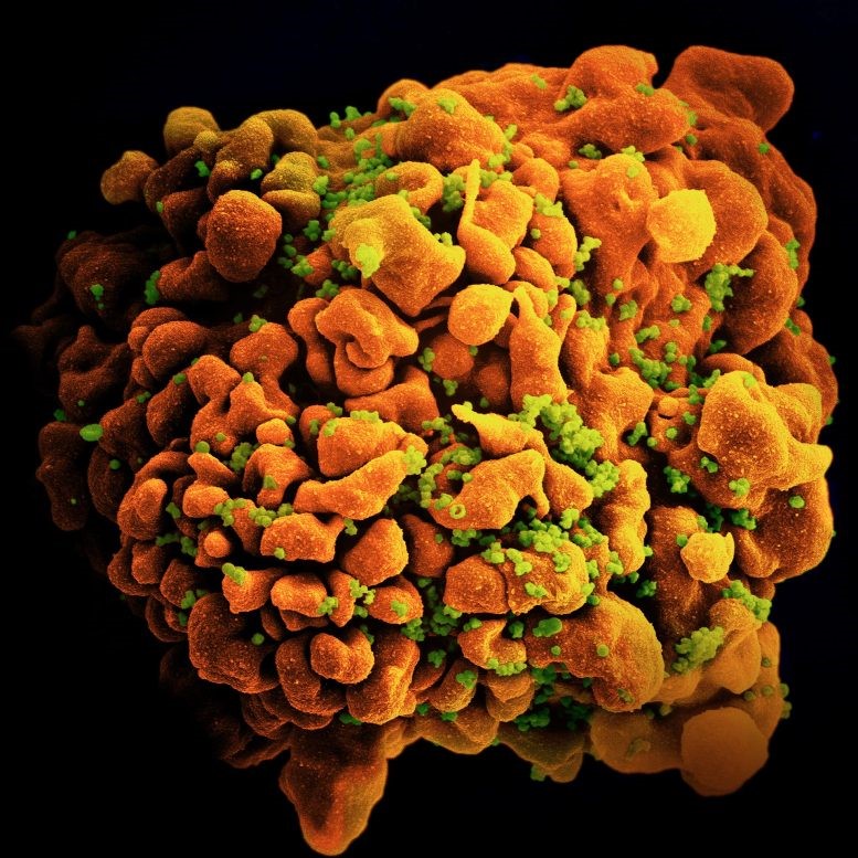 HIV