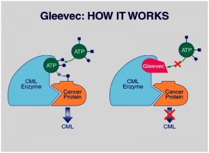 لوسمی مزمن میلوئیدی