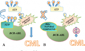 لوسمی مزمن میلوئیدی