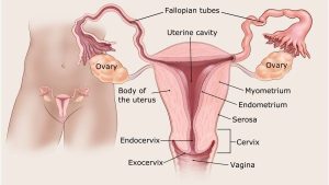 سرطان آندومتر (Endometrial Cancer)