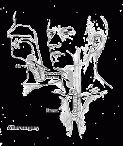 سرطان ‌حفره دهانی