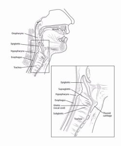 سرطان حنجره و هیپوفارنکس