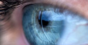 کم خوابی باعث اختلال بینایی و تخریب سلول‌های بنیادی قرنیه می‌شود!