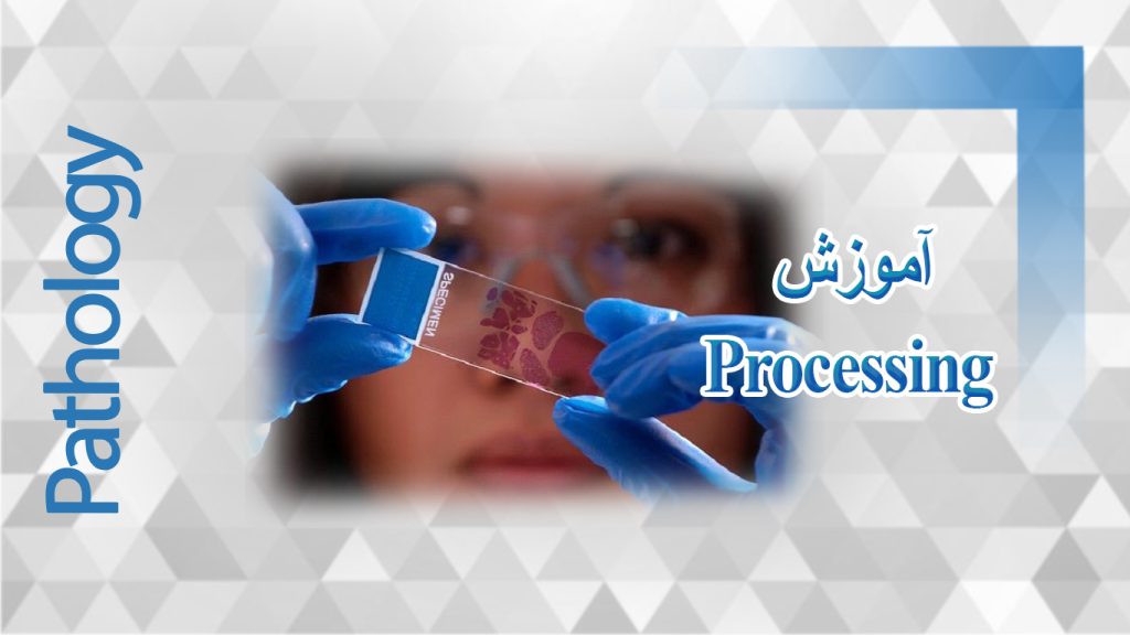 processiing