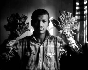  5 بیماری عجیب 