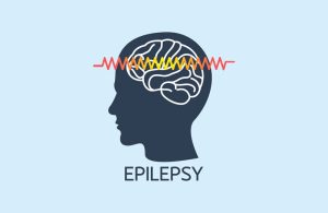 صرع (Epilepsy) 