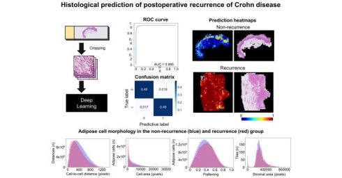 هوش مصنوعی می‌تواند عود مجدد بیماری کرون را با موفقیت پیش‌بینی کند!