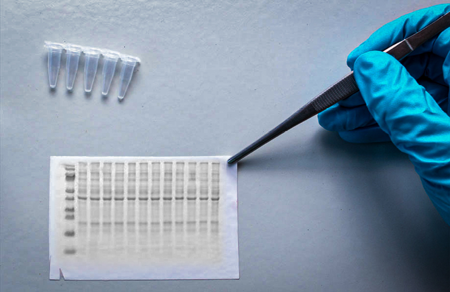 Western blot