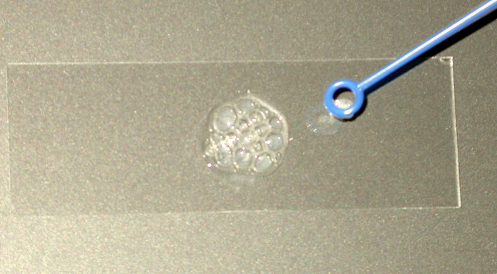 تست کاتالاز لام