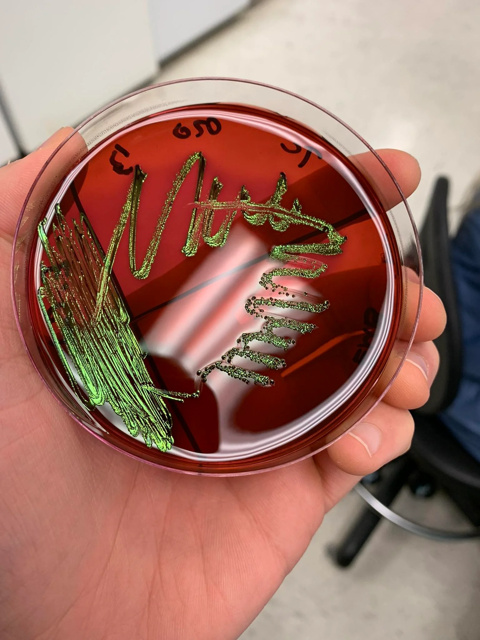 emb agar green