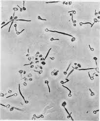 تست لوله زایا